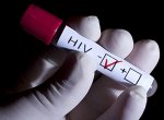 Lidé se mohou v Opavě na náměstí nechat bezplatně otestovat na HIV, žloutenku a syfilis